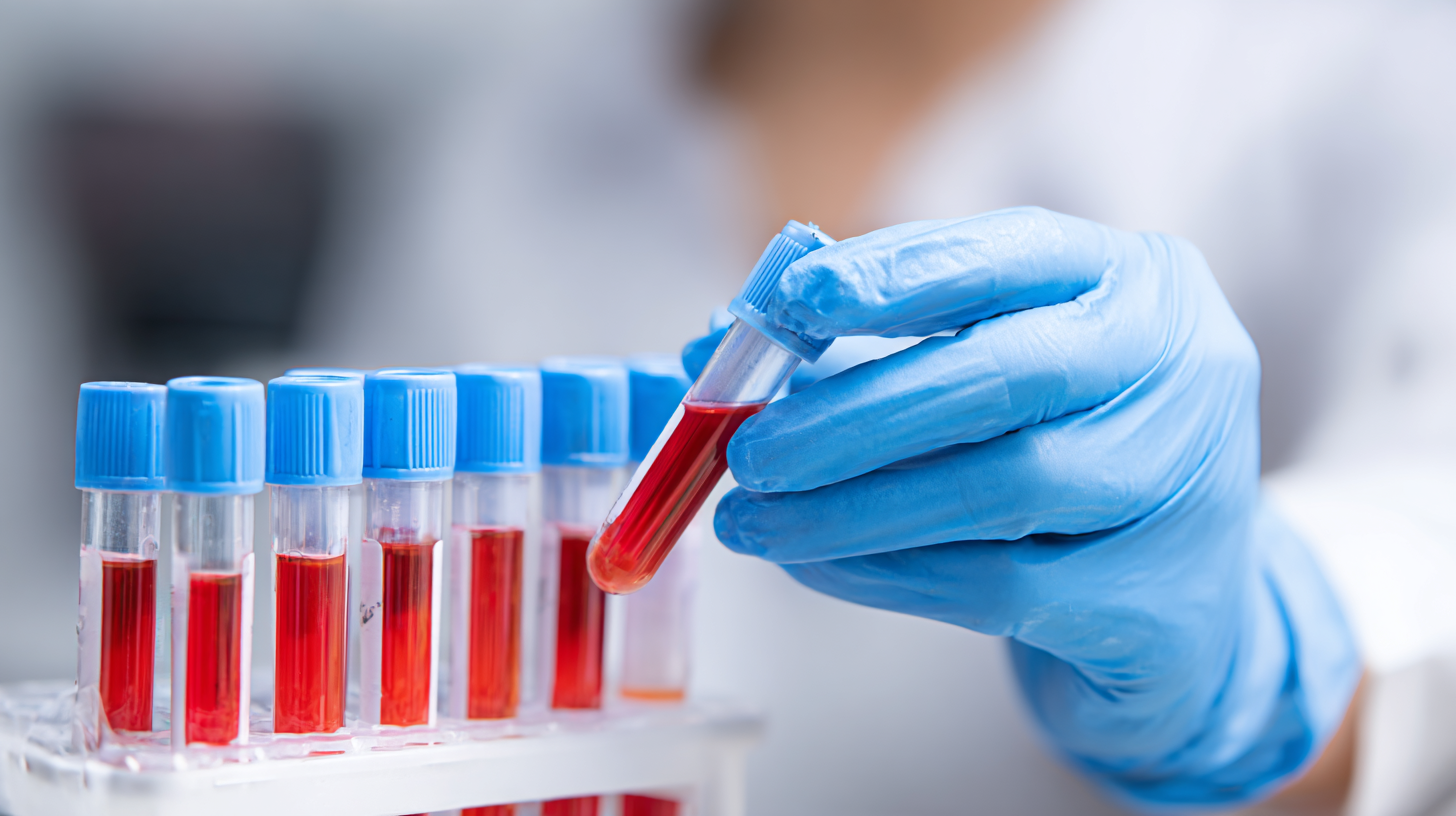 7 Reasons Why Choosing a Wholesale Rapid Diagnostic Test for Dengue Manufacturer Matters