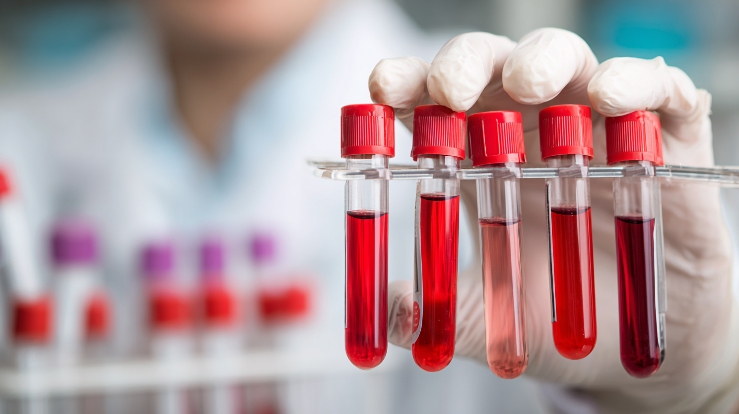 5 Essential Tips for Boosting Your Wholesale Diagnostic Test For Dengue Sales