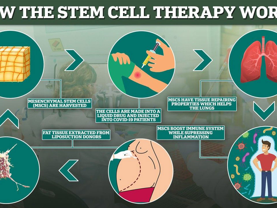 Stem Cell Therapy at Bioocus Overview