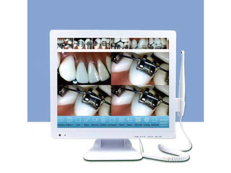 Η Shanghai JPS Medical Co., Ltd εισάγει την πρωτοποριακή ενδοστοματική κάμερα για βελτιωμένη οδοντική διάγνωση