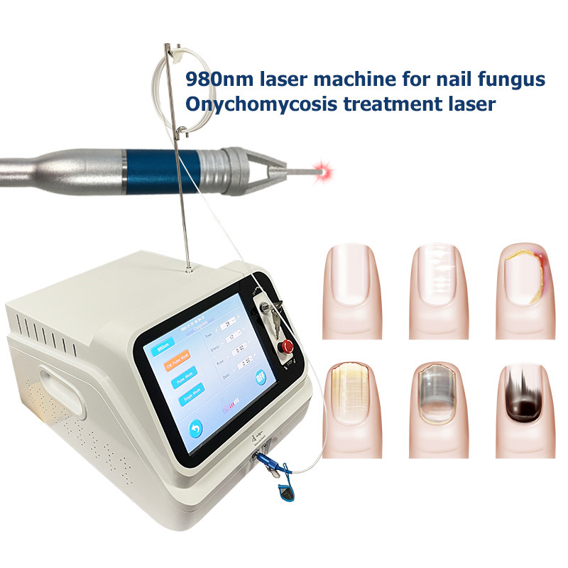 Nail Cleaning Laser Device 980nm 1064nm (4)0mf
