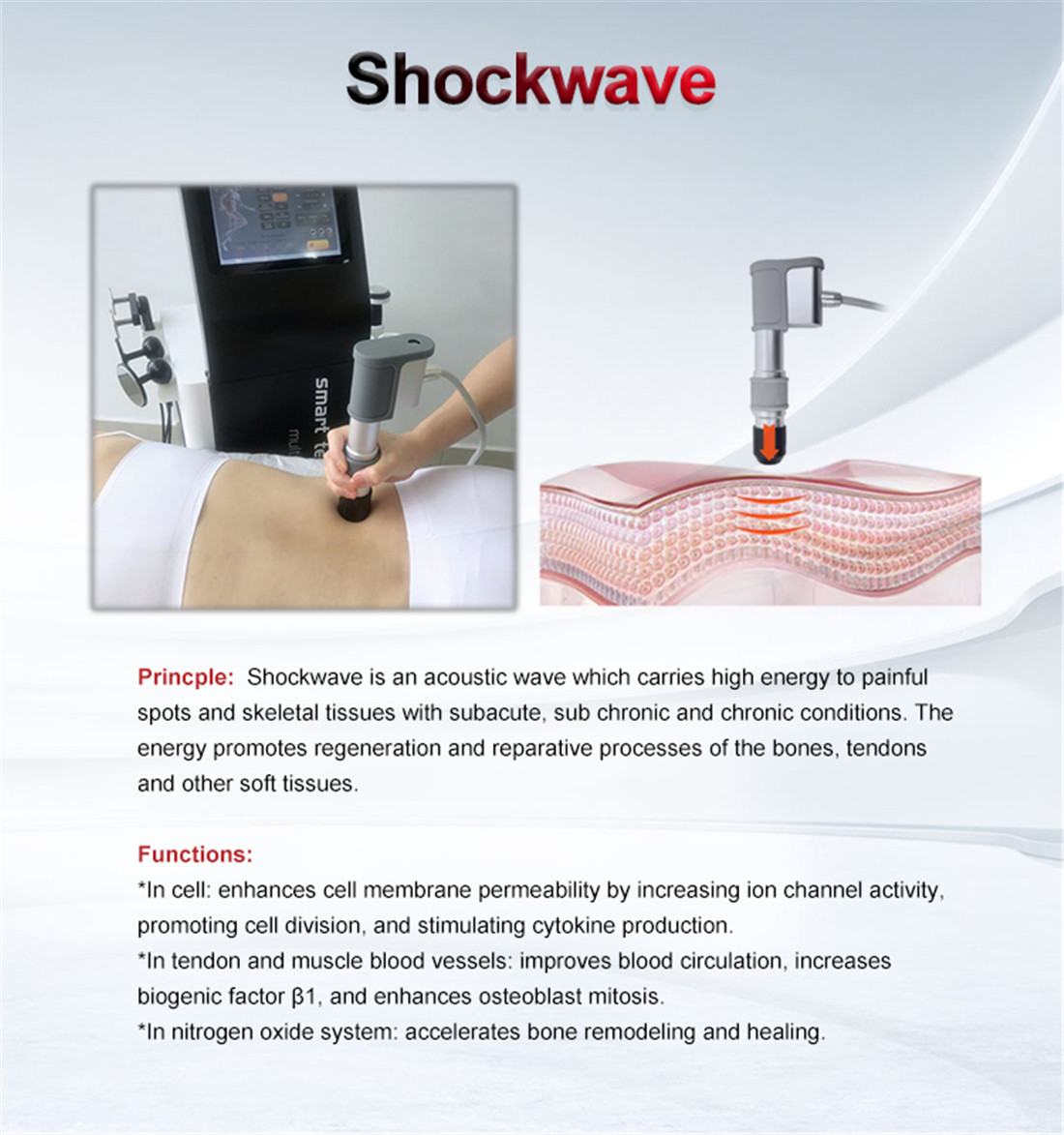 Shockwave Device 01 (5)2vy