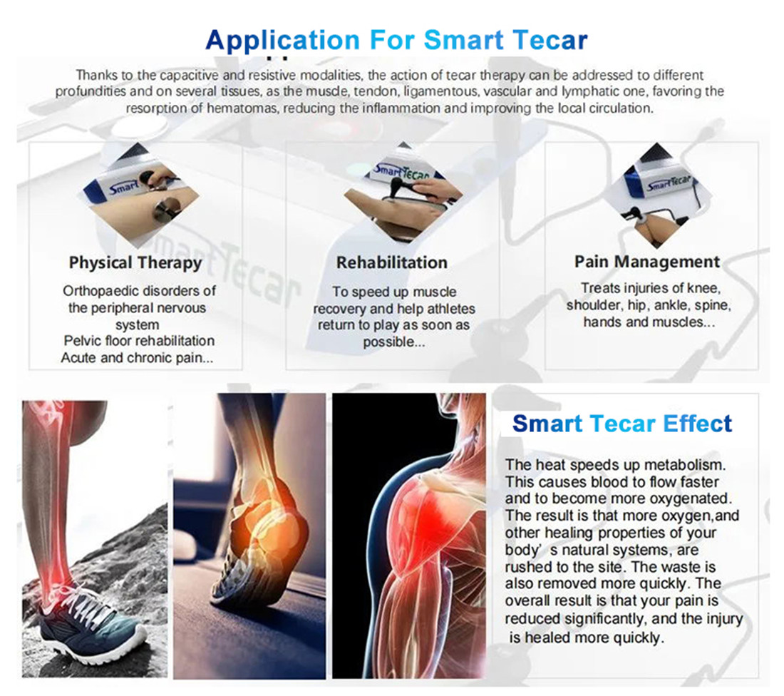 Smart Tecar (4)60k