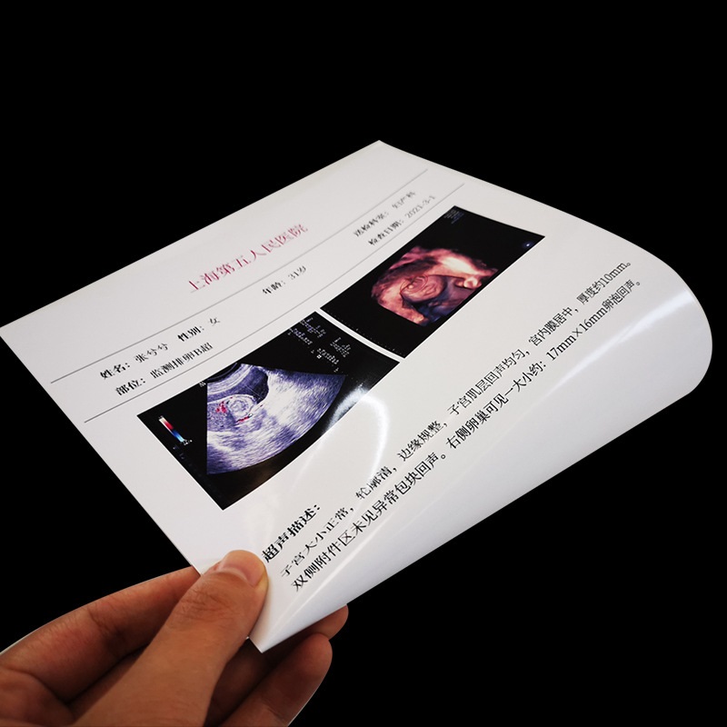 초음파 건식 PET 백색 잉크젯 레이저 의료용 필름
