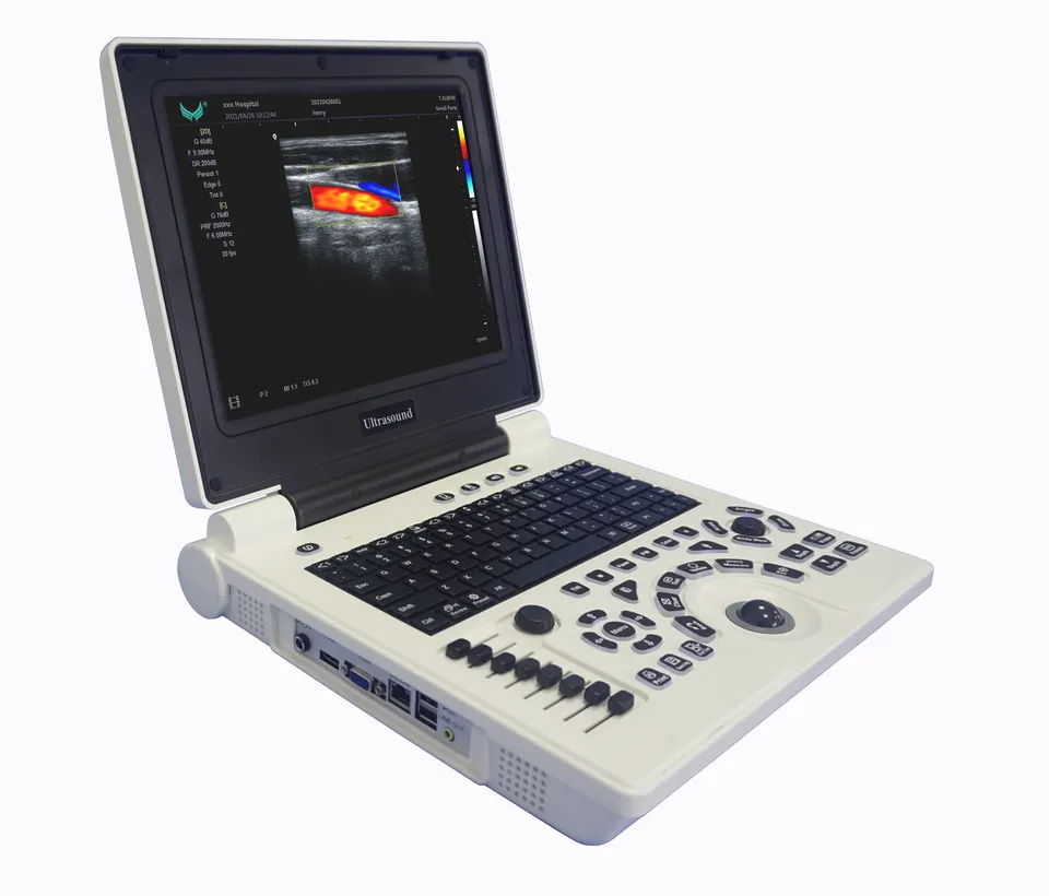 Ucuz Xianfeng e20 ultrason tarayıcı taşınabilir renkli doppler 3d taşınabilir ultrason makinesi