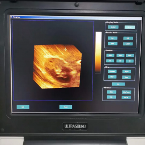 cheap Xianfeng e20 ultrasound scanner portable color doppler 3d portable ultrasound machine