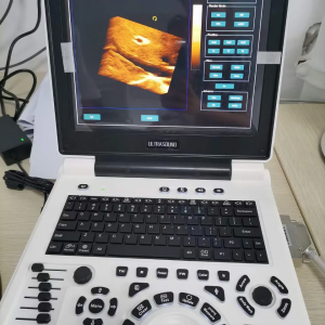 cheap Xianfeng e20 ultrasound scanner portable color doppler 3d portable ultrasound machine