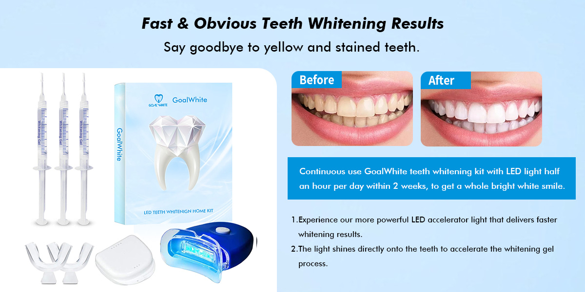 LED Teeth whitening home kit GW-HK002  005gfx