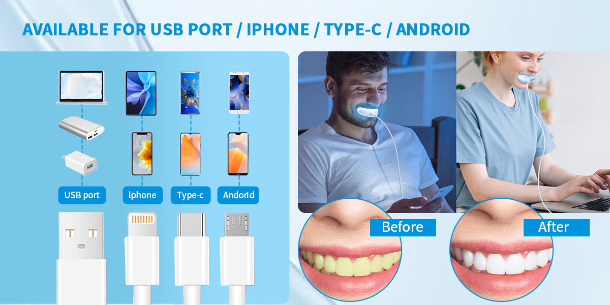 LED teeth whitening home kit GW-HK101A4 006qgv