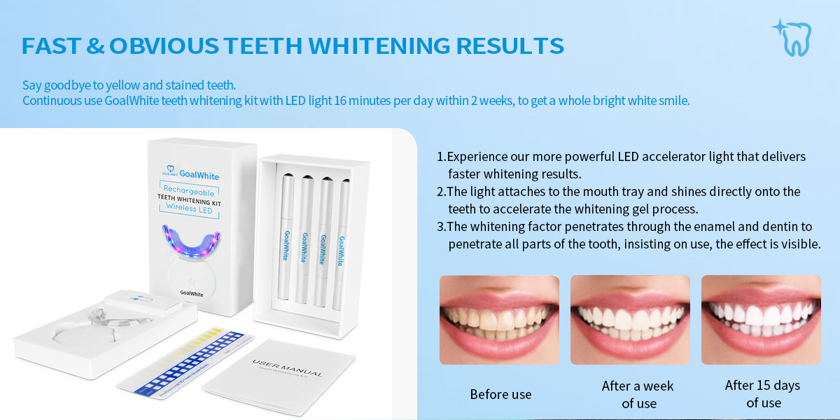 LED teeth whitening home kit GW-HK102R1 0097c4