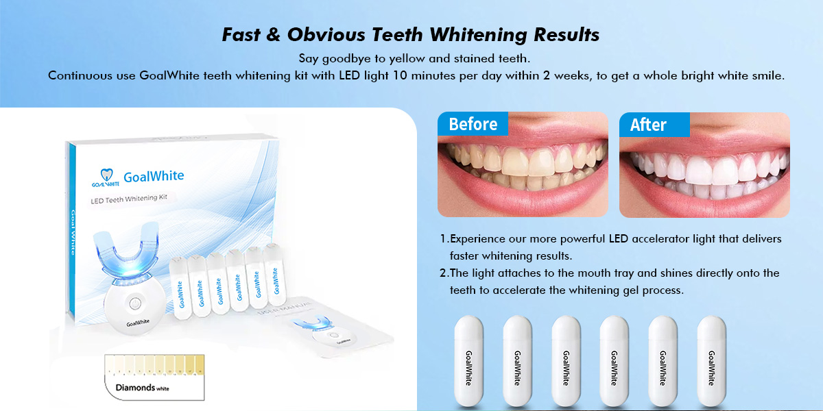 LED teeth whitening home kit  GW-PAP01 0057jv