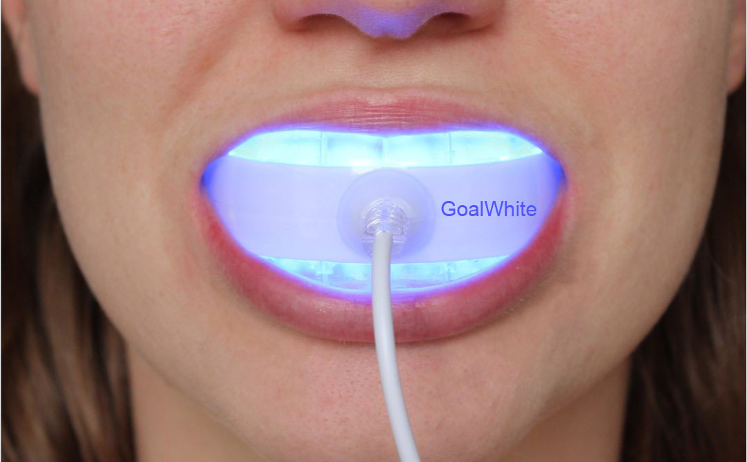 Exploring The Latest Teeth Whitening Trends of 2024 What's New (3)ggc