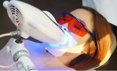 OEM ODM How to Start a Teeth Whitening Business (4)s58