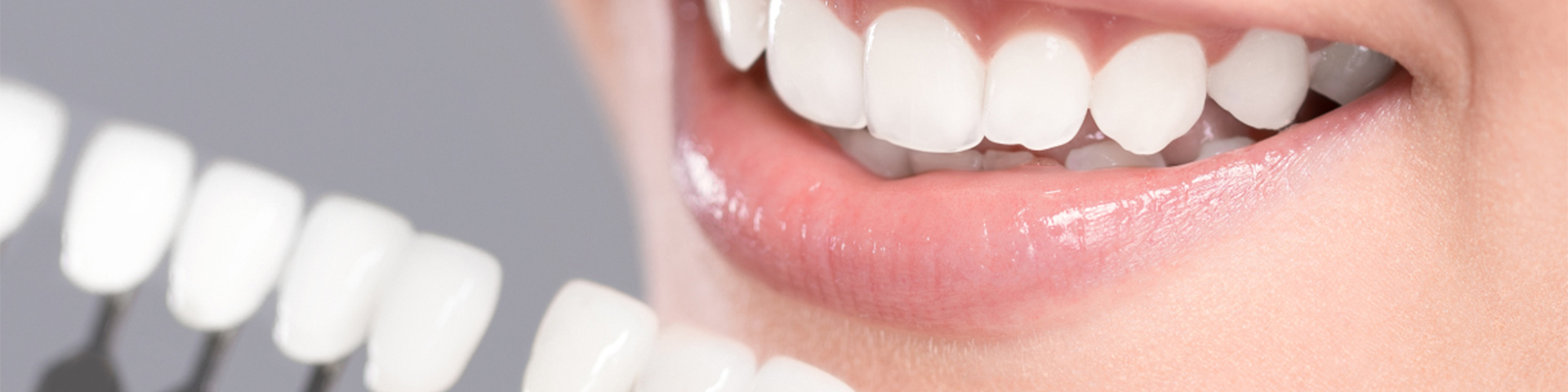 Teeth Whitening Accessories