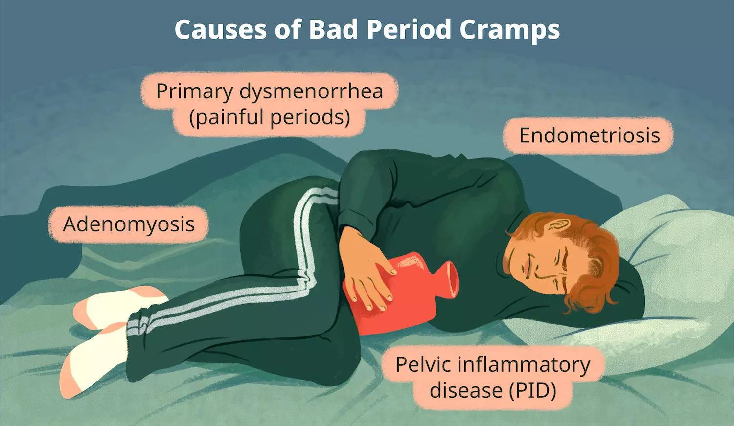 causas del dolor menstrualu33