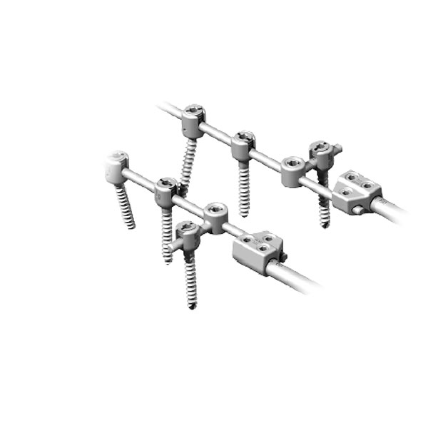 Occipitocervical Thoracic Posterior Spinal Screw-Rod System