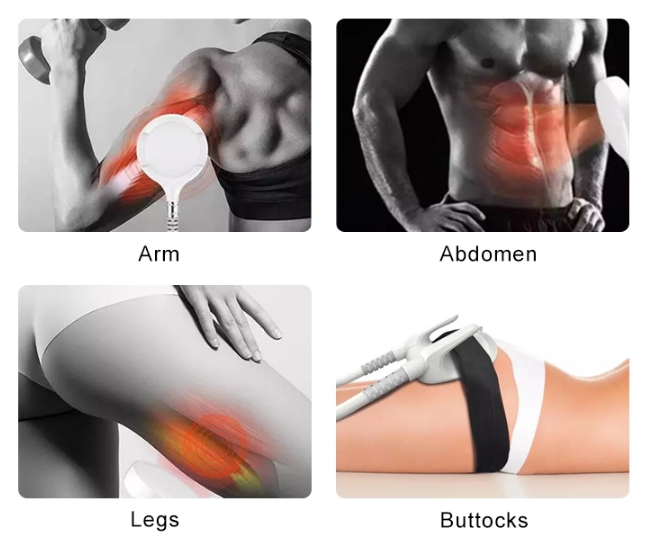 Какво представлява устройството Emsculpt за изграждане на мускули?