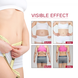 Effective body smooth kumashape slimming rf body shaping weight loss wrinkle removal machine