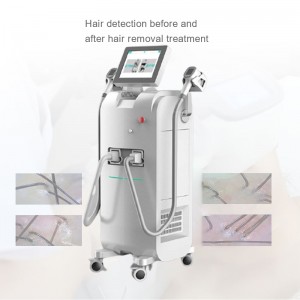 755nm 808nm sy 1064nm Diode Laser Hair Removal Machine