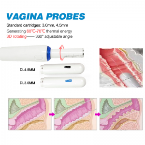 Fornecedor profissional 3 em 1 4D HIFU e Vmax HIFU e máquina de aperto vaginal