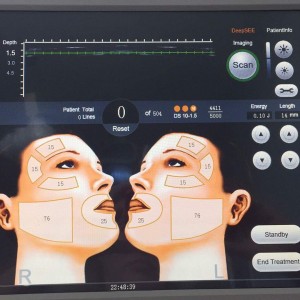 2D הסרת קמטים מיצוק עור הרמת פנים HIFU Ultrasound
