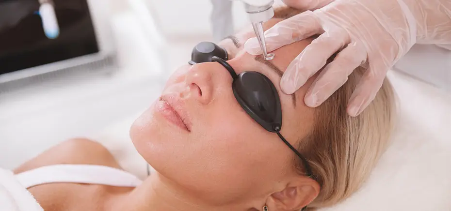 The Magic of Q Switch Laser: The Ultimate Solution for Pigmentation Removal