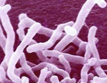 Food Grade Probiotica-supplementen Bifidobacterium Lactis