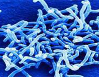 Probiotik Aditif Pangan Massal Bifidobacterium Longum