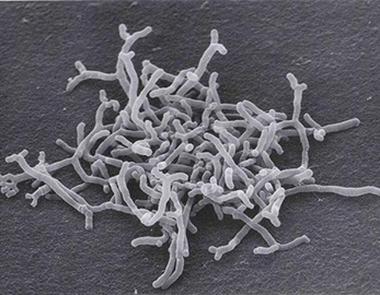 Aditivos alimentarios probióticos a granel Bifidobacterium Bifidum en polvo