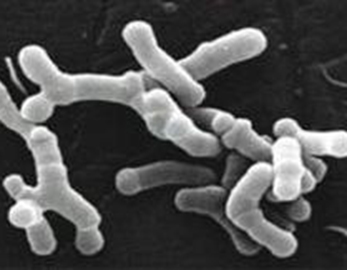 Saglygy goraýyş probiotikleri Bifidobacterium Infantis