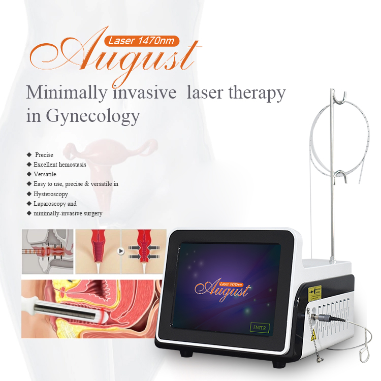 laser Mchine da ginecologia 1470nm