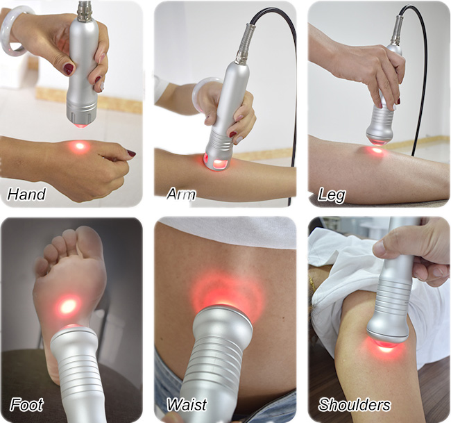 physiotherapy laser (1)qo0
