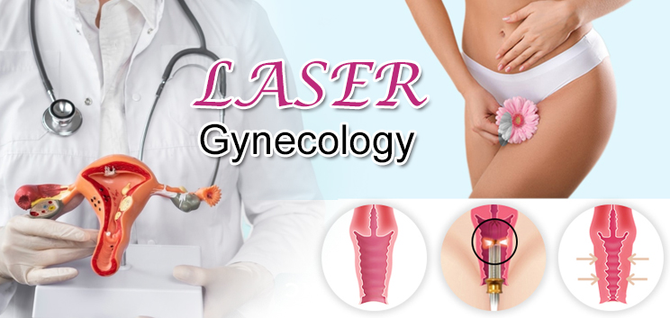 Gynecology Laser (2)9o1