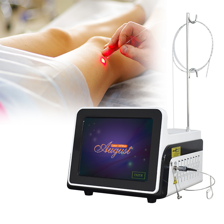 Điều trị suy giãn tĩnh mạch bằng Laser nội tĩnh mạch bằng Laser Diode 1470nm