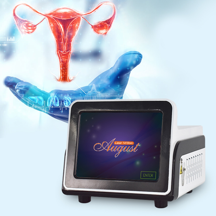 Minimalinvasiver 1470-nm-Diodenlaser zur Vaginalstraffung