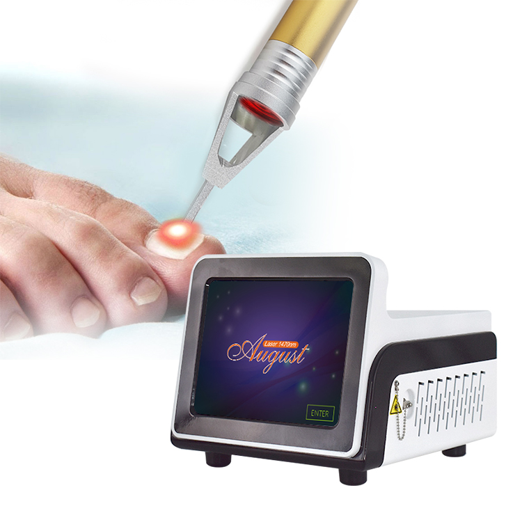 Dispositivo de laser de diodo 980nm para tratamento de onicomicose por fungos nas unhas