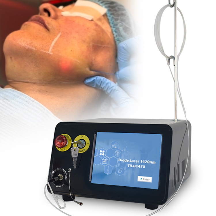 Endoskin – machine laser à diode 1470nm, lifting du cou et du visage, TR-B1470