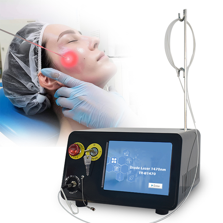 Why Is 1470nm The Optimal Wavelength For Endo Laserlift (Skin Lifting )?