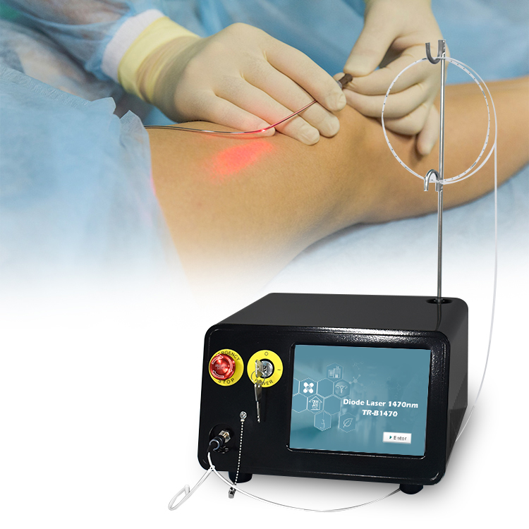 Laser điều trị giãn tĩnh mạch 1470nm EVLT laser TR-B1470